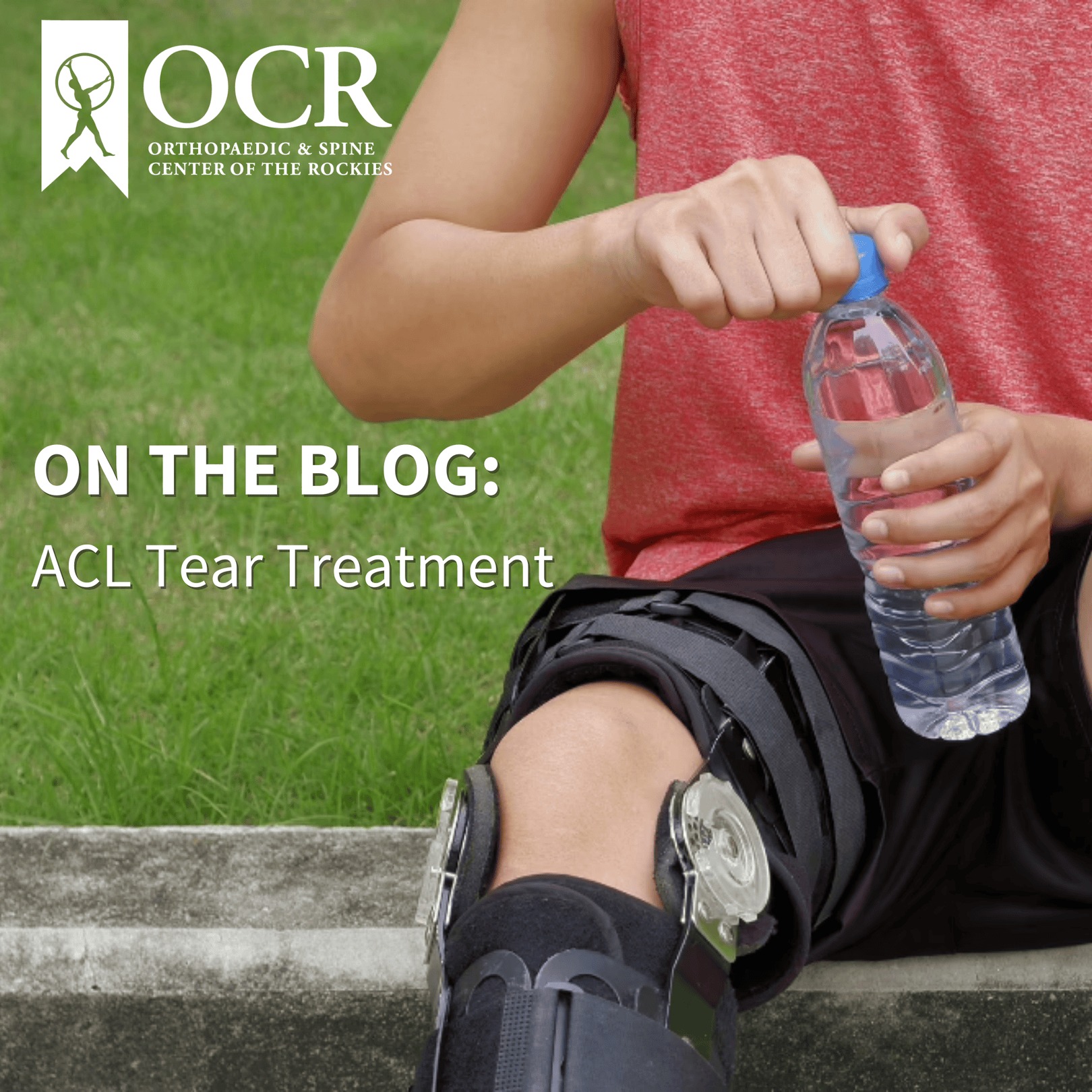 Orthopaedic - An ACL tear is one of the most common and frustrating ...