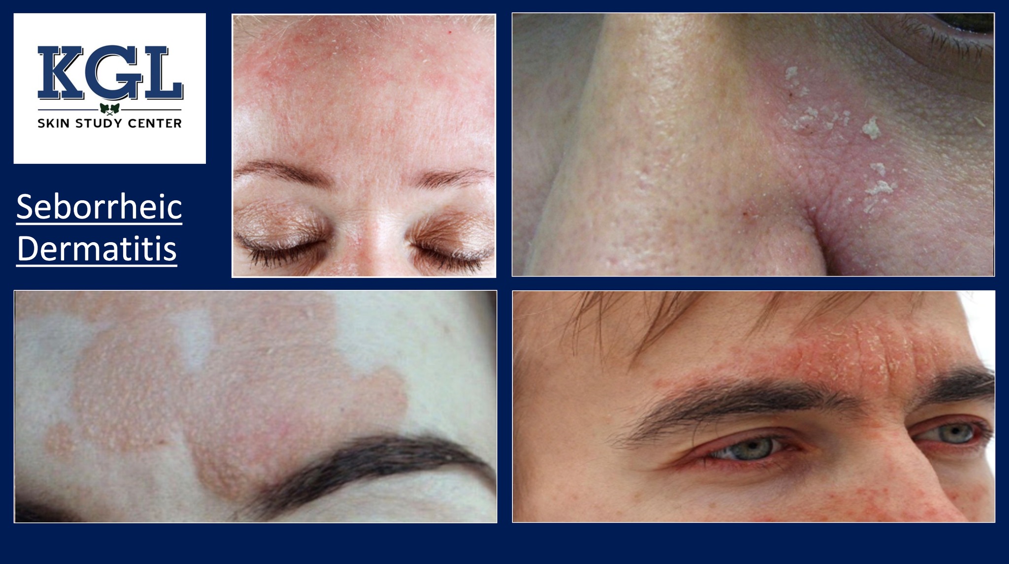 Dermico Lab and KGL Skin Study Center | Broomall PA