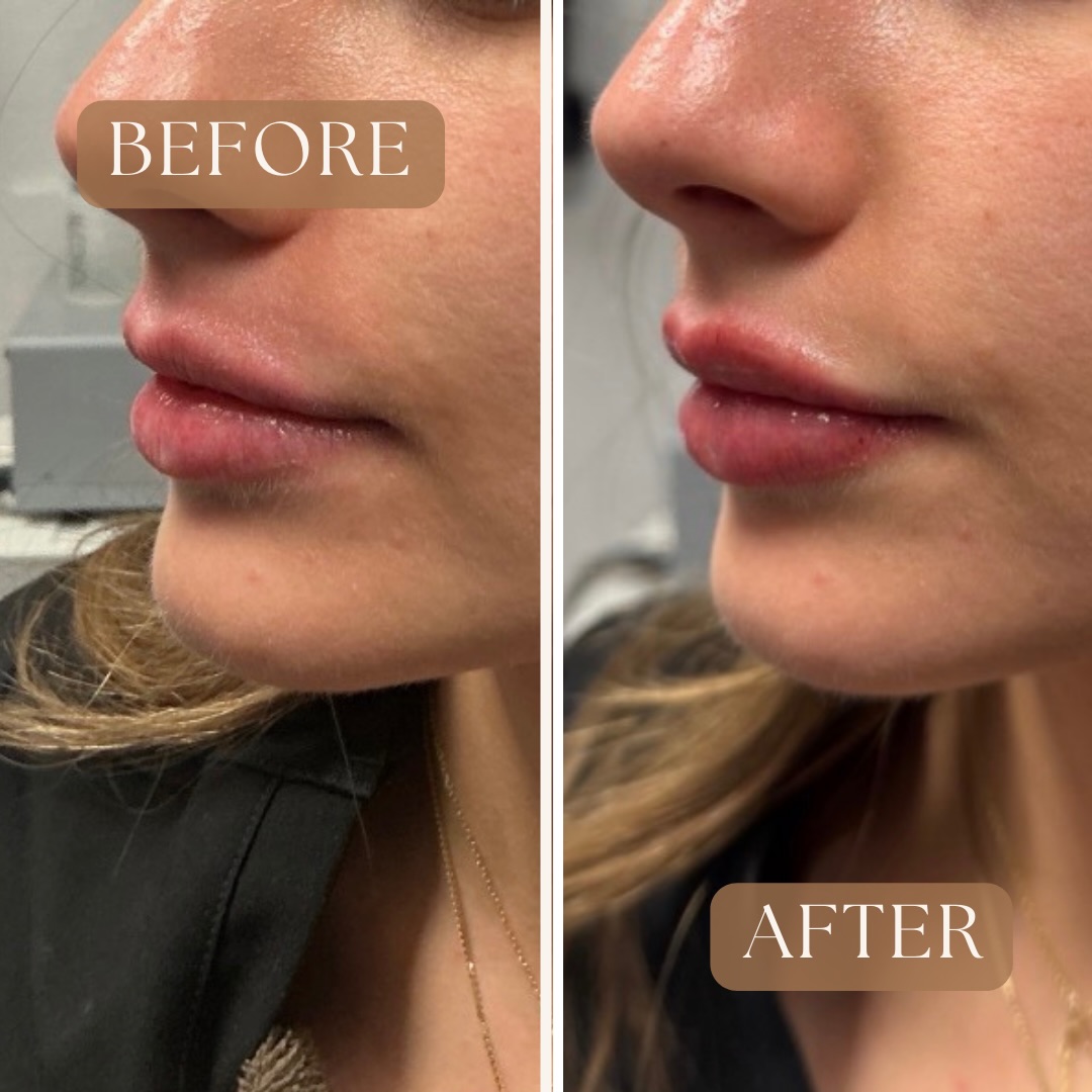 Posh Salon & Medical Spa | Reno NV