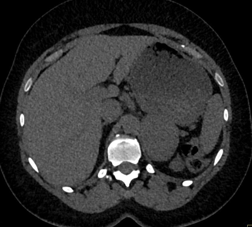 CTisus: Cutting edge information on body CT (Computed tomography ...