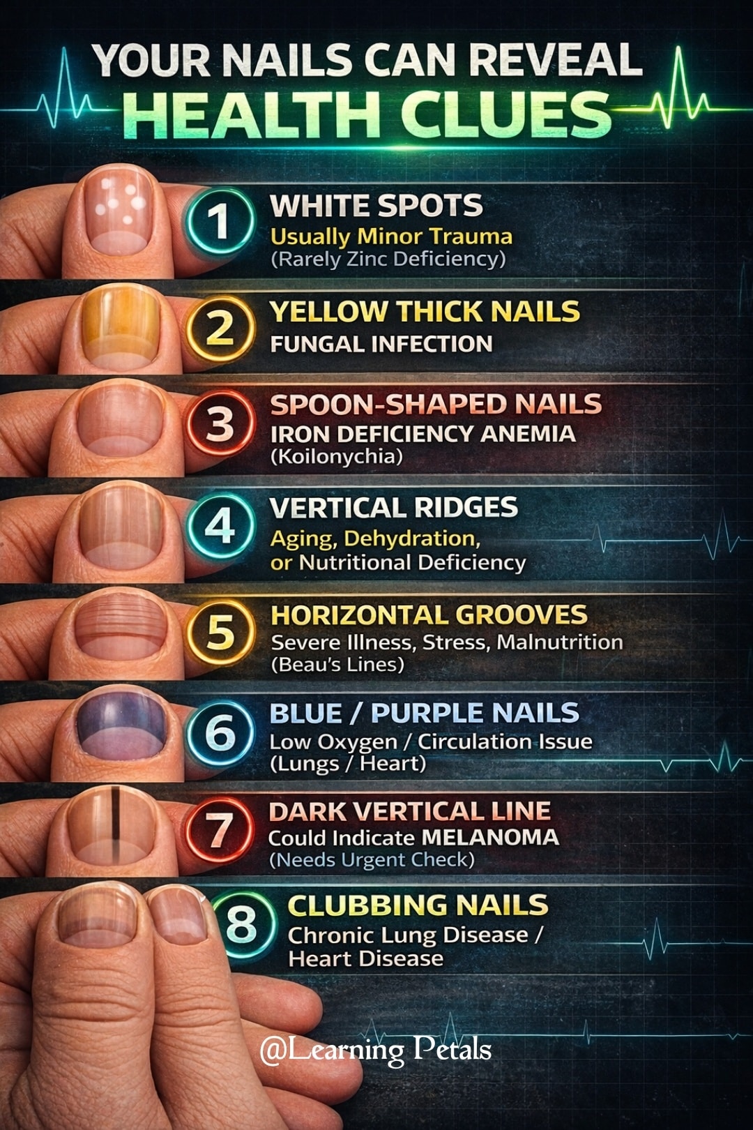 Warning Sign About Nail You Should Never Ignore Your nails can reflect systemic health changes before lab results shift. Recognizing patterns early helps guide proper clinical testing and interpretation. Key Nail Signs