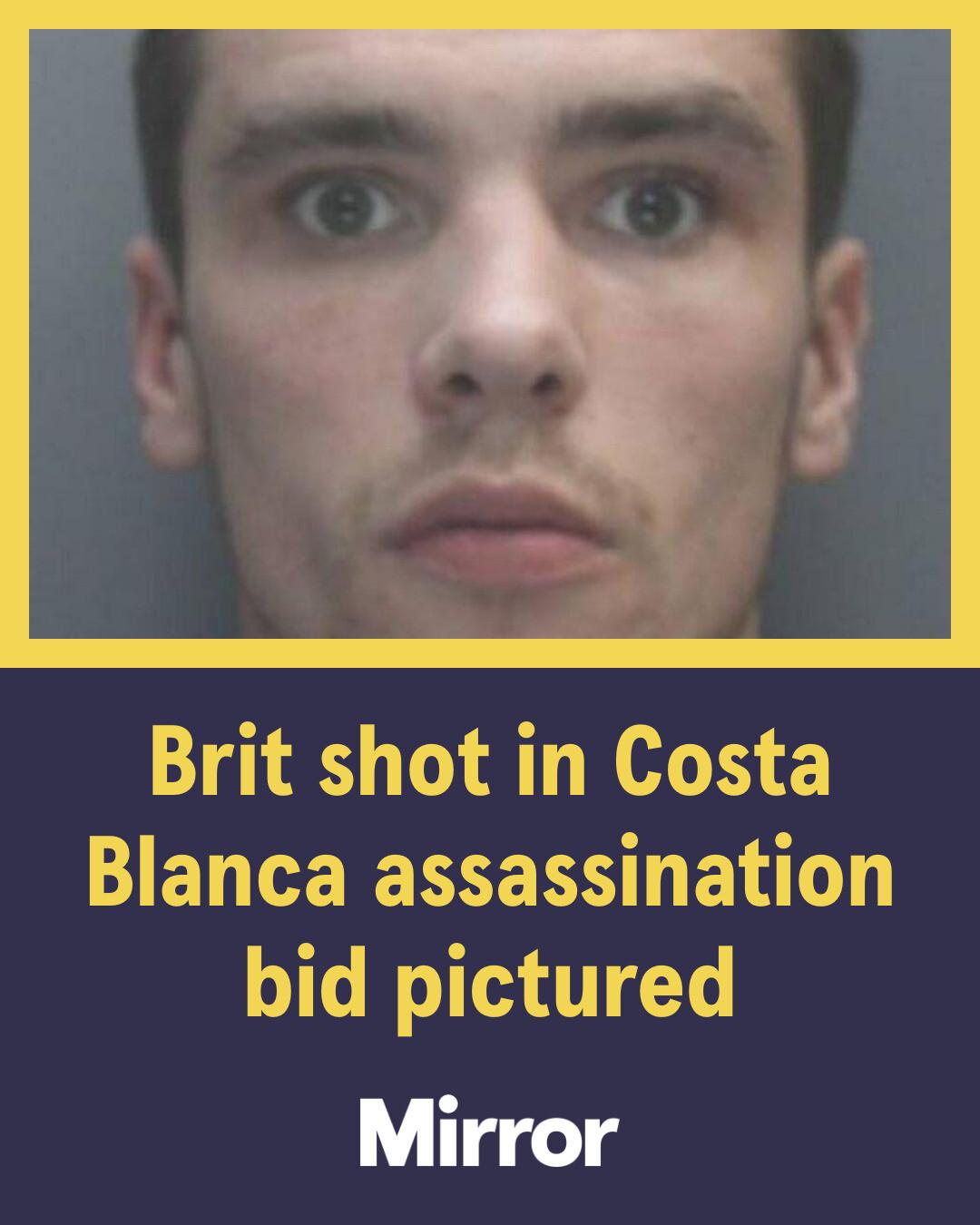 The Mirror - A British man who was shot multiple times in a botched ...