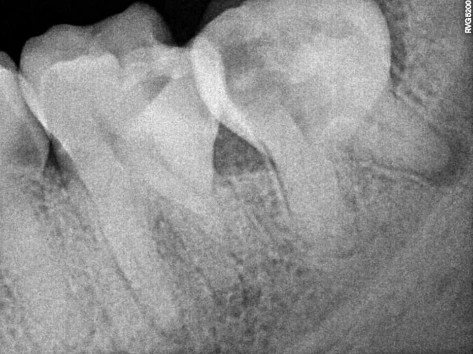 Zahns Dental Clinic added a new photo. - Zahns Dental Clinic