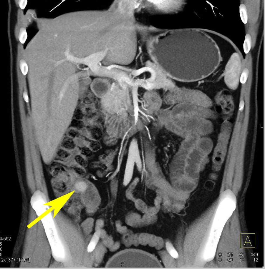 CTisus: Cutting edge information on body CT (Computed tomography ...