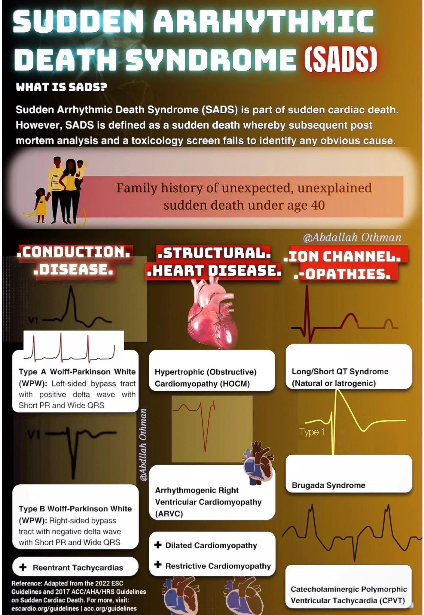 Wetton - Sudden Arrhythmic Death Syndrome (SADS): The Silent Threat ⚡🫀 ...
