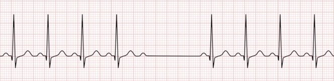 CodeHealth