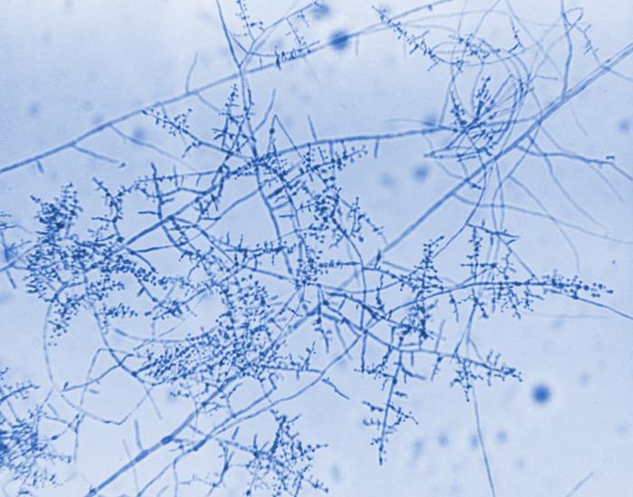 Infectious - #Trichophyton mentagrophytes genotype VII (TMVII) is a ...