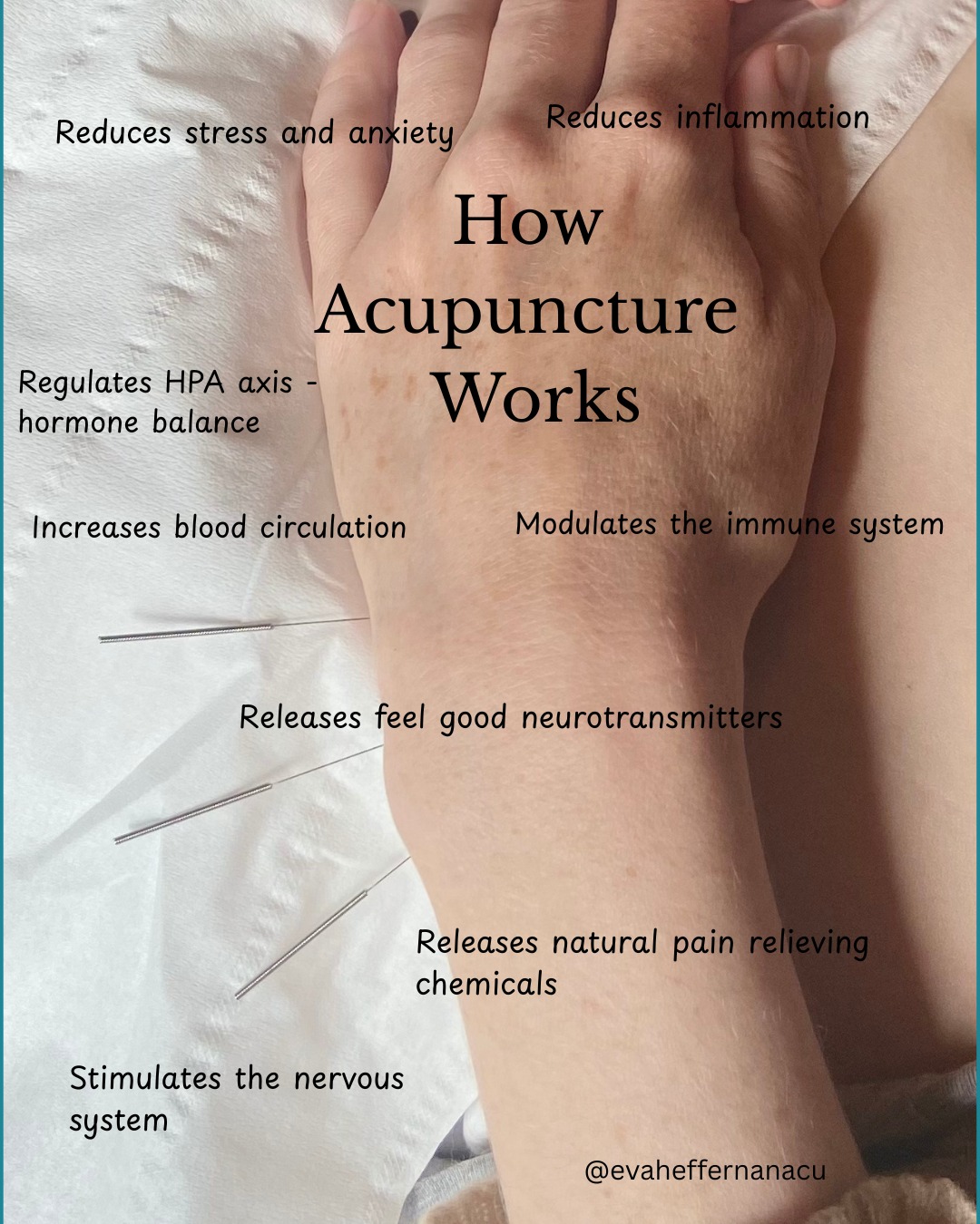 10 Evidence-Based... - Log House Clinic, Eva Heffernan Acu | Facebook