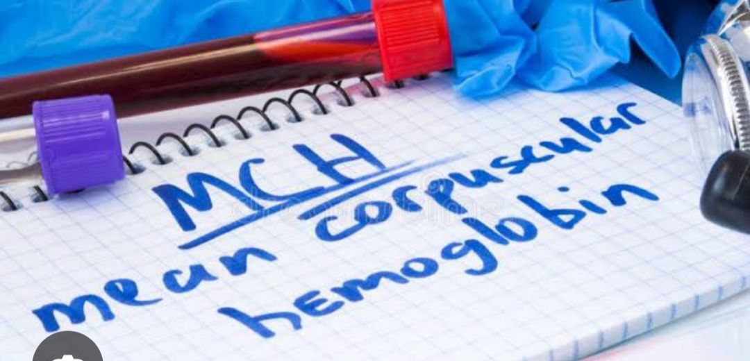 hyperchromic anemia المصطلح ده مش... - Dr.Shahenaz Elsamanody | Facebook