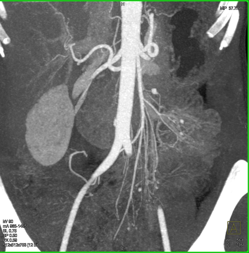 CTisus: Cutting edge information on body CT (Computed tomography ...
