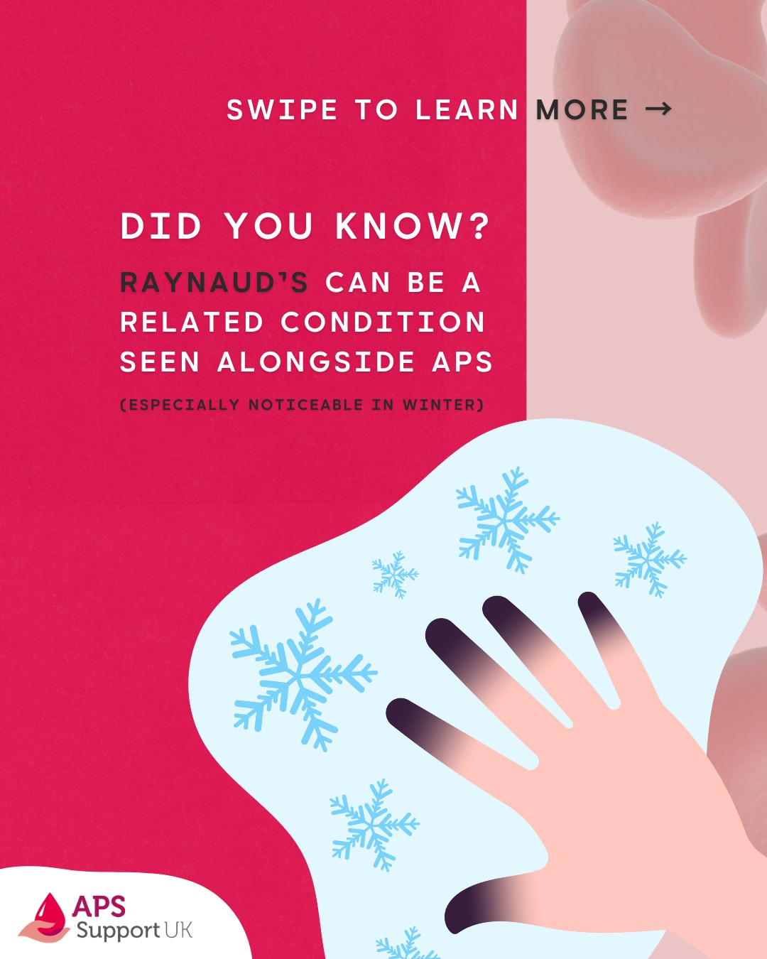 ️ Did you know? Raynaud’s can be a related condition seen alongside APS ...