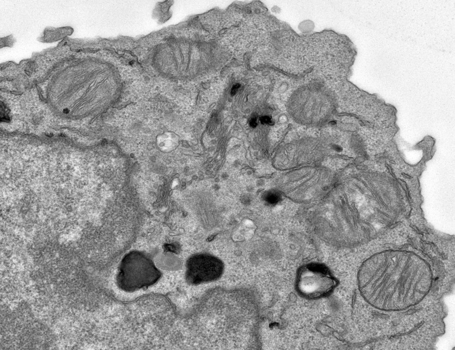 carlson labs glutathione booster 180 capsules The metabolite citraconate can preserve T cell stemness and suppress exhaustion, promoting antitumor immunity and responses to immunotherapies in mice. Learn more in #ScienceImmunology: https://scim.ag/4cIoUzZ Histamine Intolerance - Tringali baerrytop_230317 Size:160 Tablets