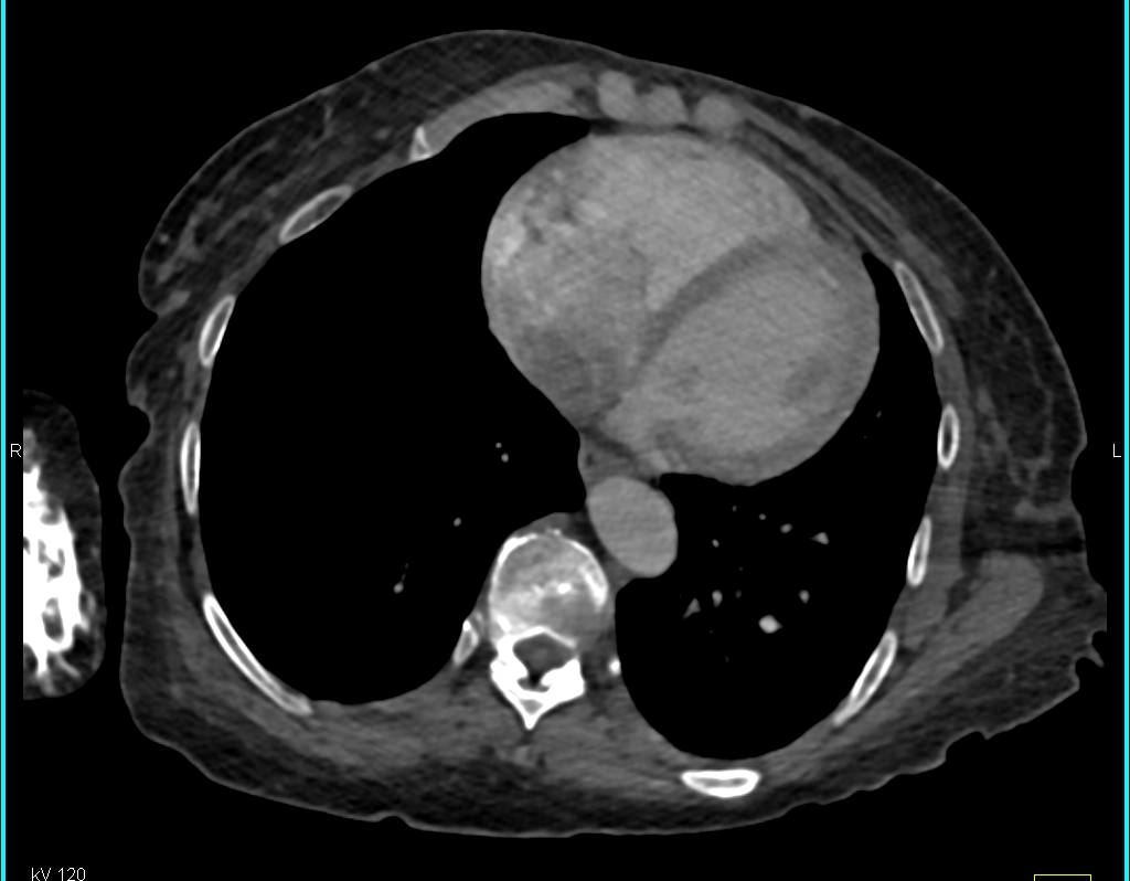 Gastric... - CTisus: Cutting edge information on body CT (Computed ...