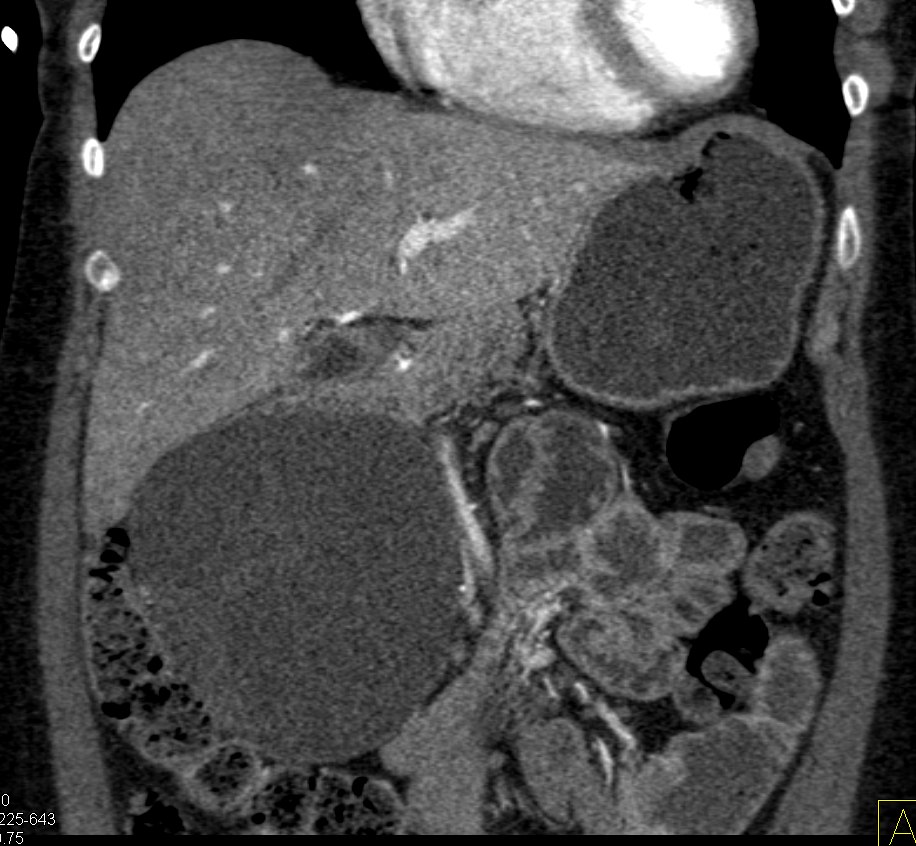 CTisus: Cutting edge information on body CT (Computed tomography ...