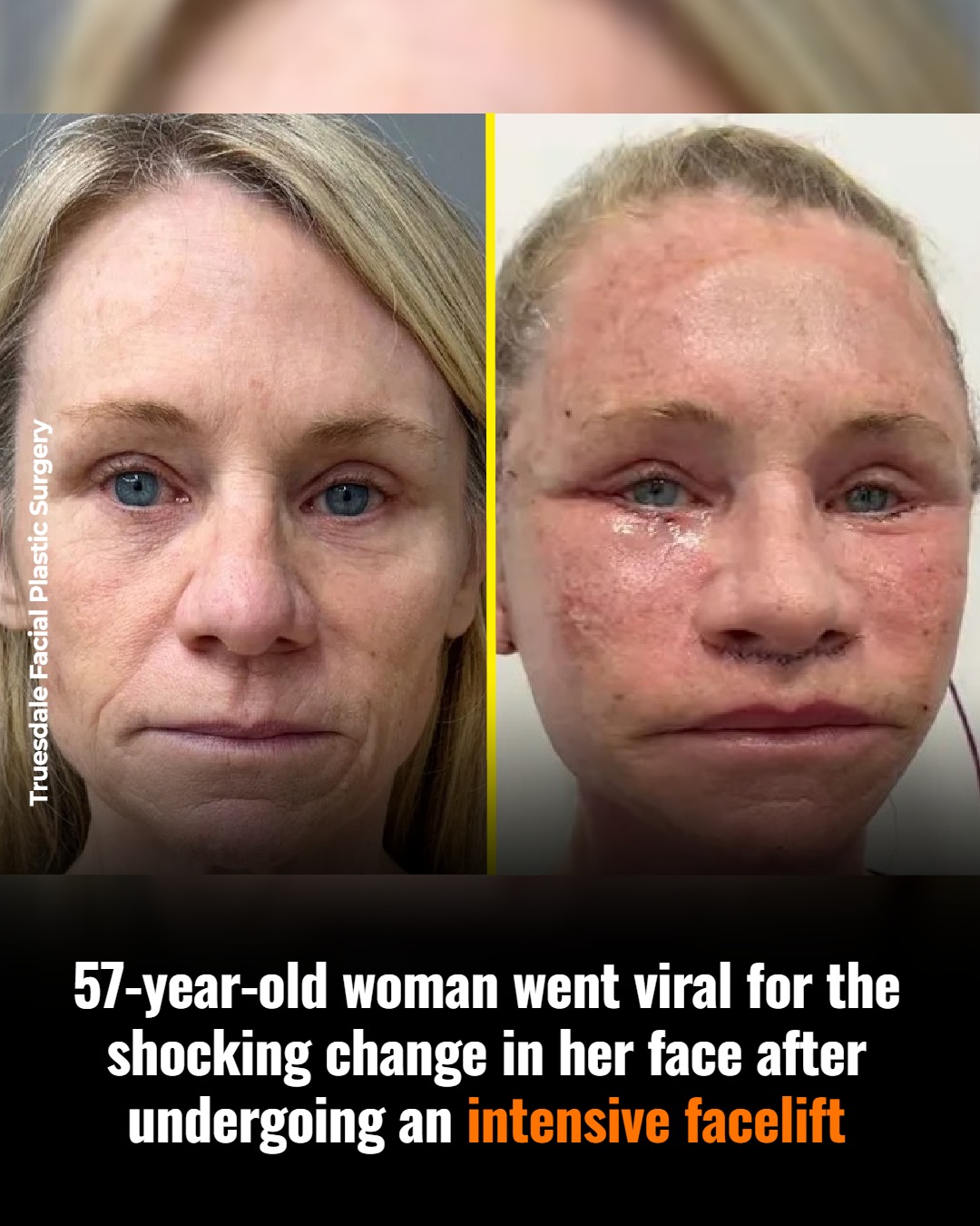 Vitamin - A 57-year-old woman went viral after appearing
