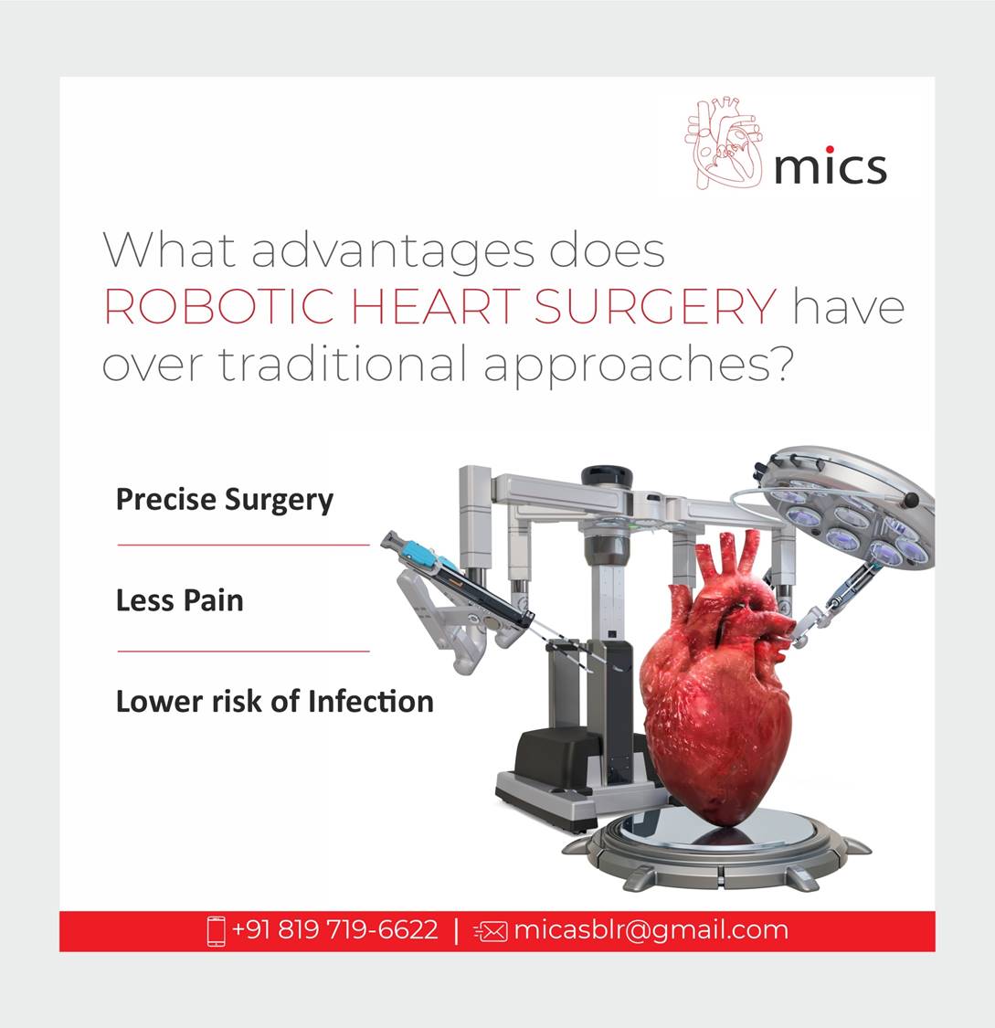 Micsheart - The MICS (Minimally Invasive Cardiac Surgery)...