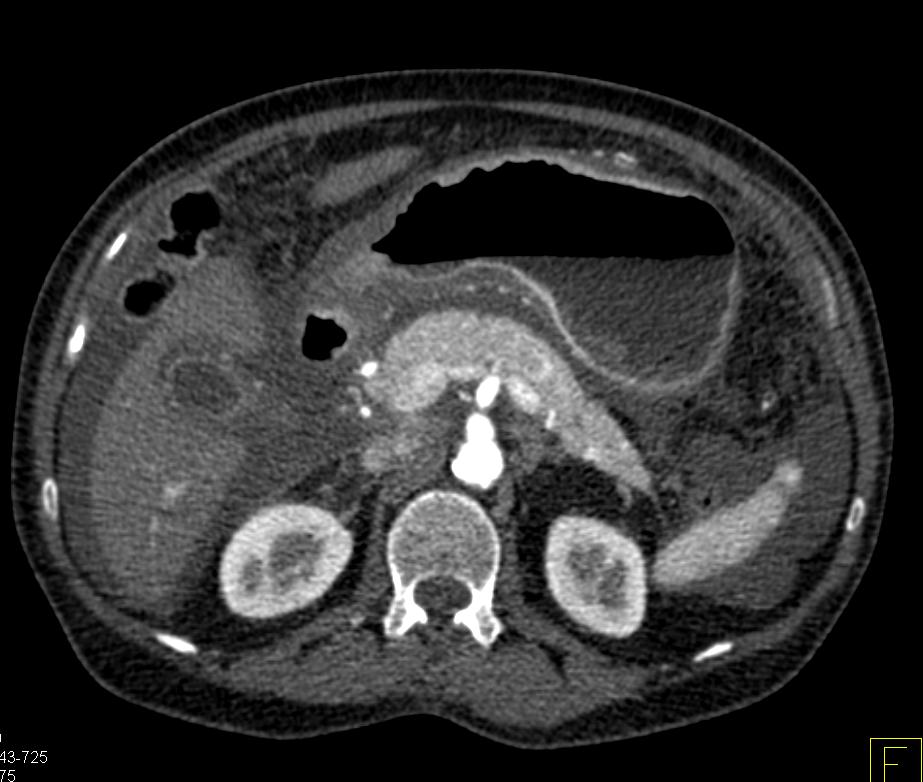 CTisus: Cutting edge information on body CT (Computed tomography ...
