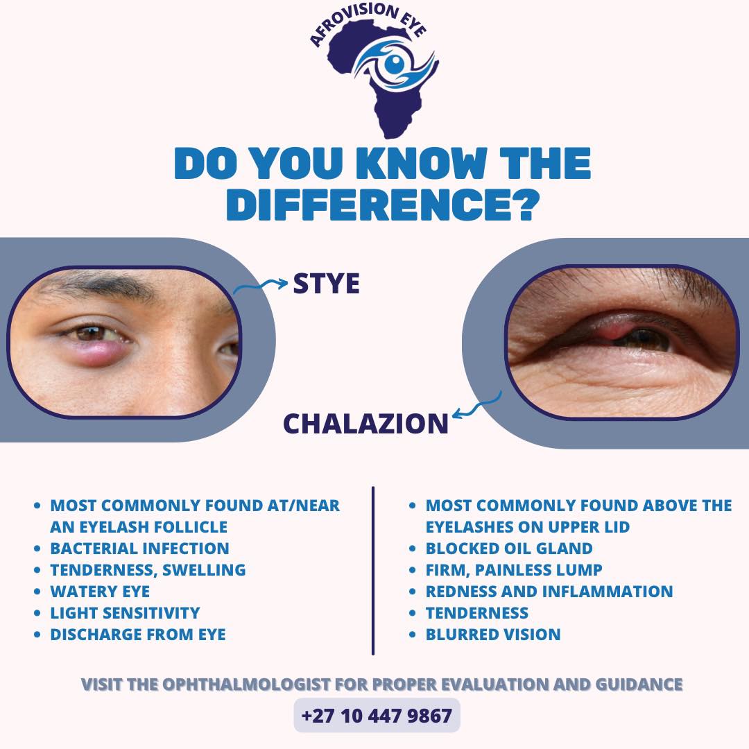 Afrovision - DO YOU HAVE A BUMP ON YOUR EYELID? Know the difference ...