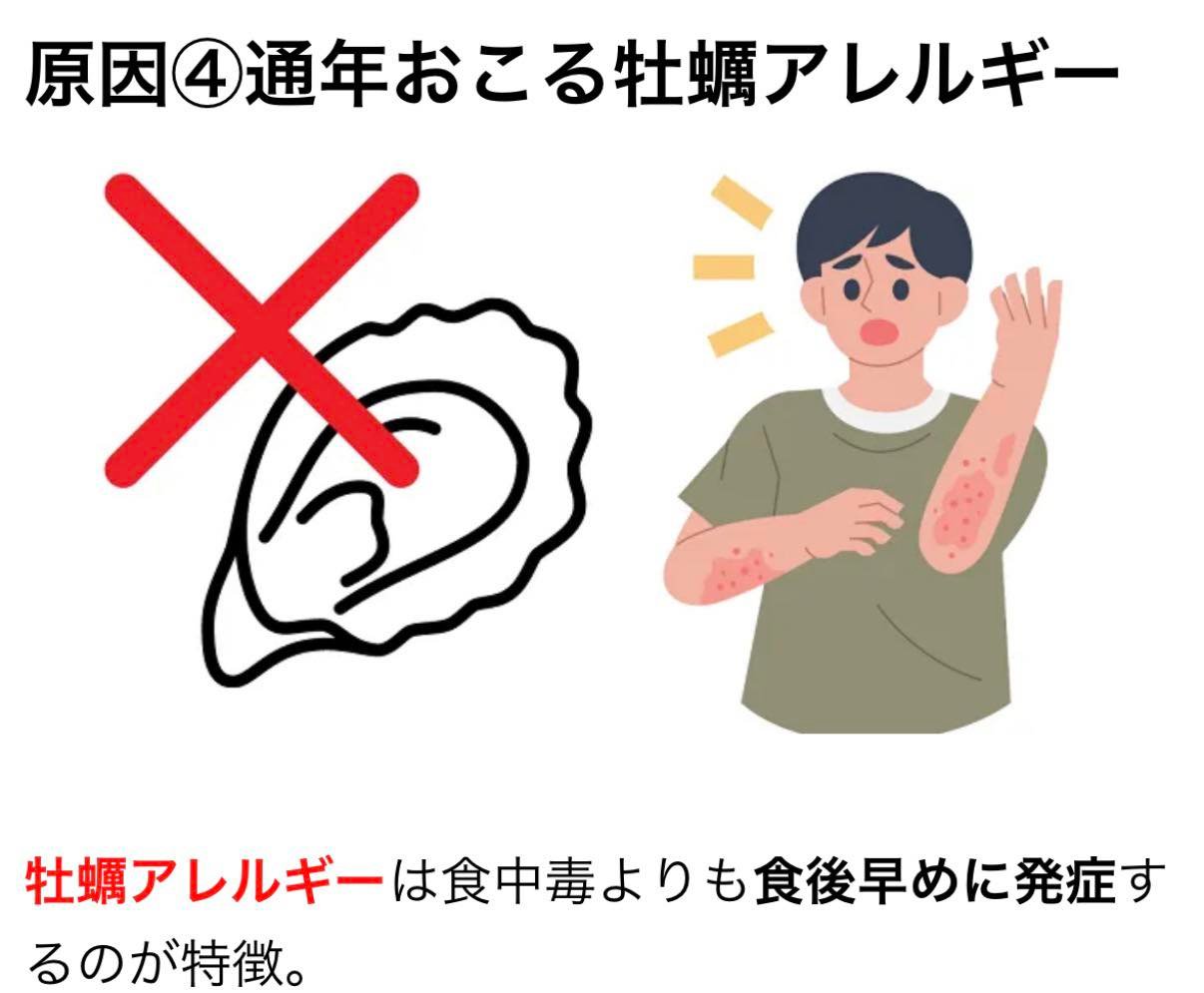 牡蠣 吐き気 だけ