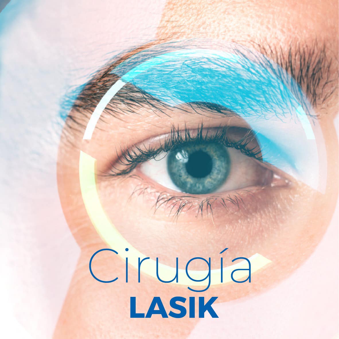 La CIRUGÍA LASIK es... - Unidad Oftalmológica de Tulancingo | Facebook
