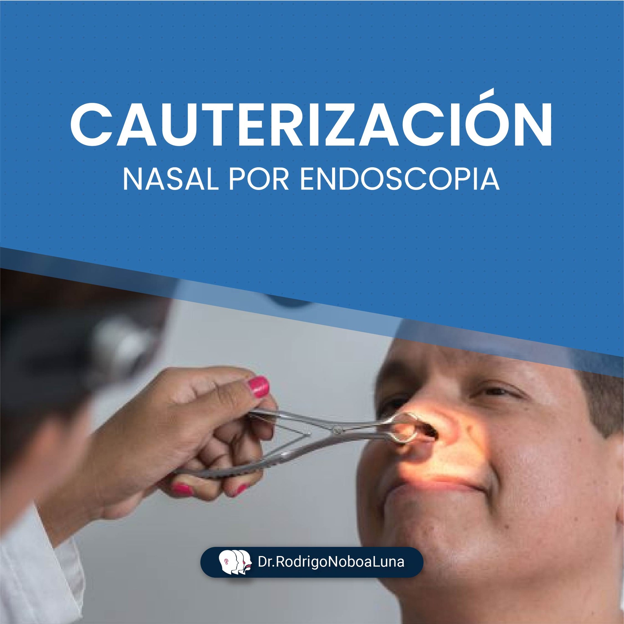 dr-rodrigo-noboa-luna-la-cauterizaci-n-es-una-t-cnica-mediante-la