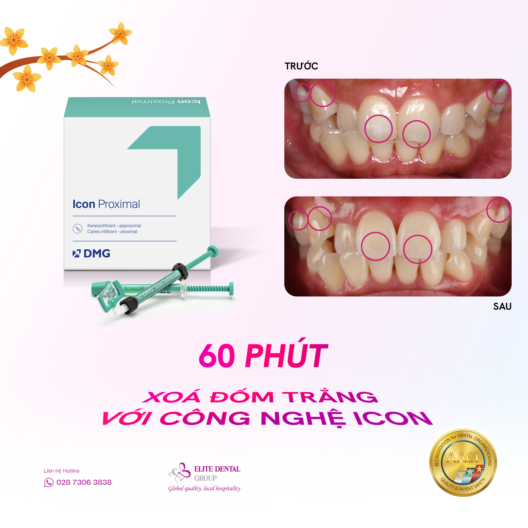 Elite - Xoá đốm trắng Icon là giải pháp can thiệp tối thiểu dành cho ...