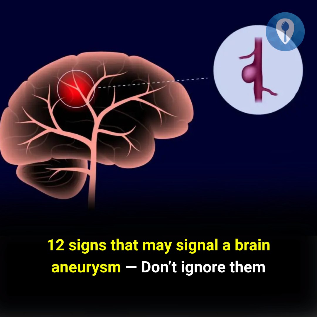 Feedy - Twelve Warning Signs That May Indicate a Brain Aneurysm: Do Not ...