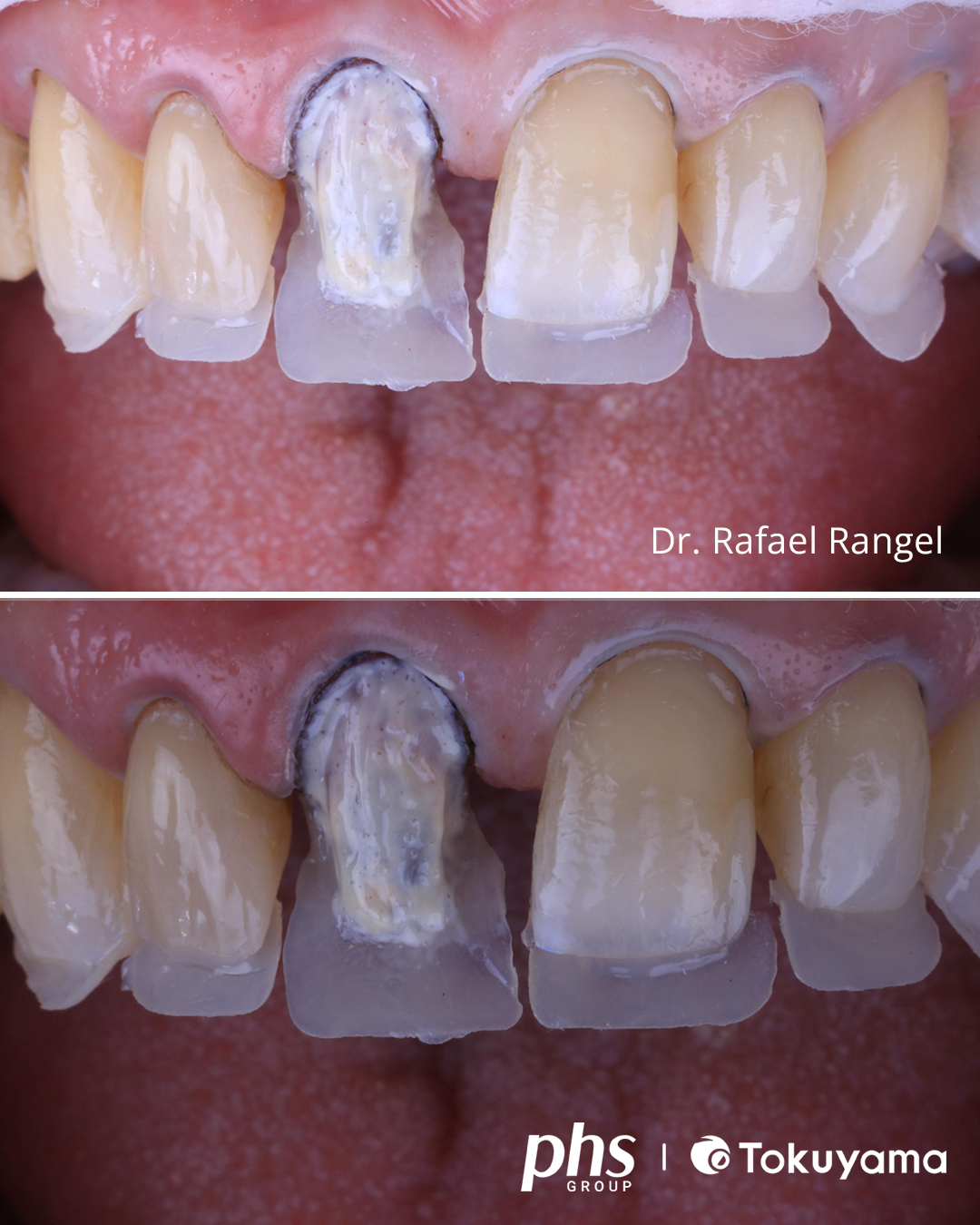 Tokuyama Dental Brasil - MAS POR QUE ELE É O MELHOR? Além destes ...