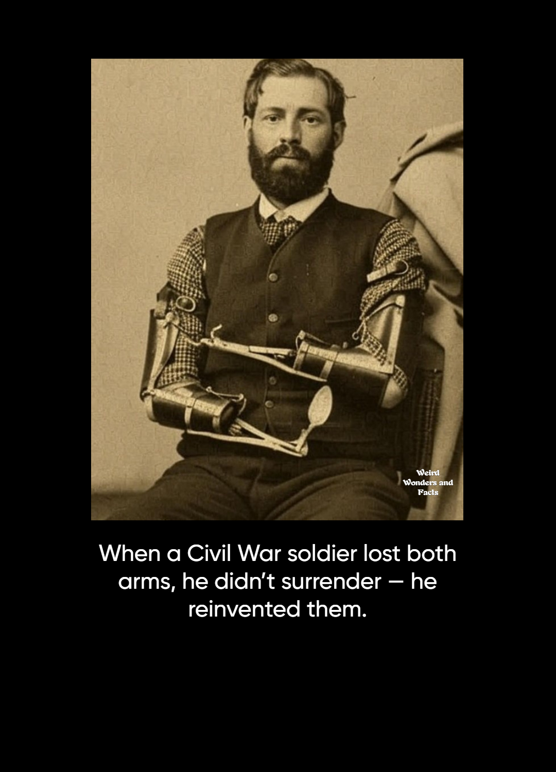 Weird - In 1862, Union soldier Samuel Decker lost half of both his arms ...
