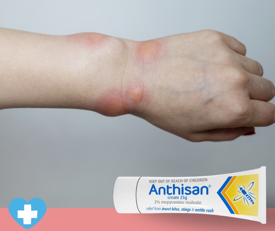 Porirua - 🐝 Itchy bite driving you crazy? Soothe the sting fast with ...