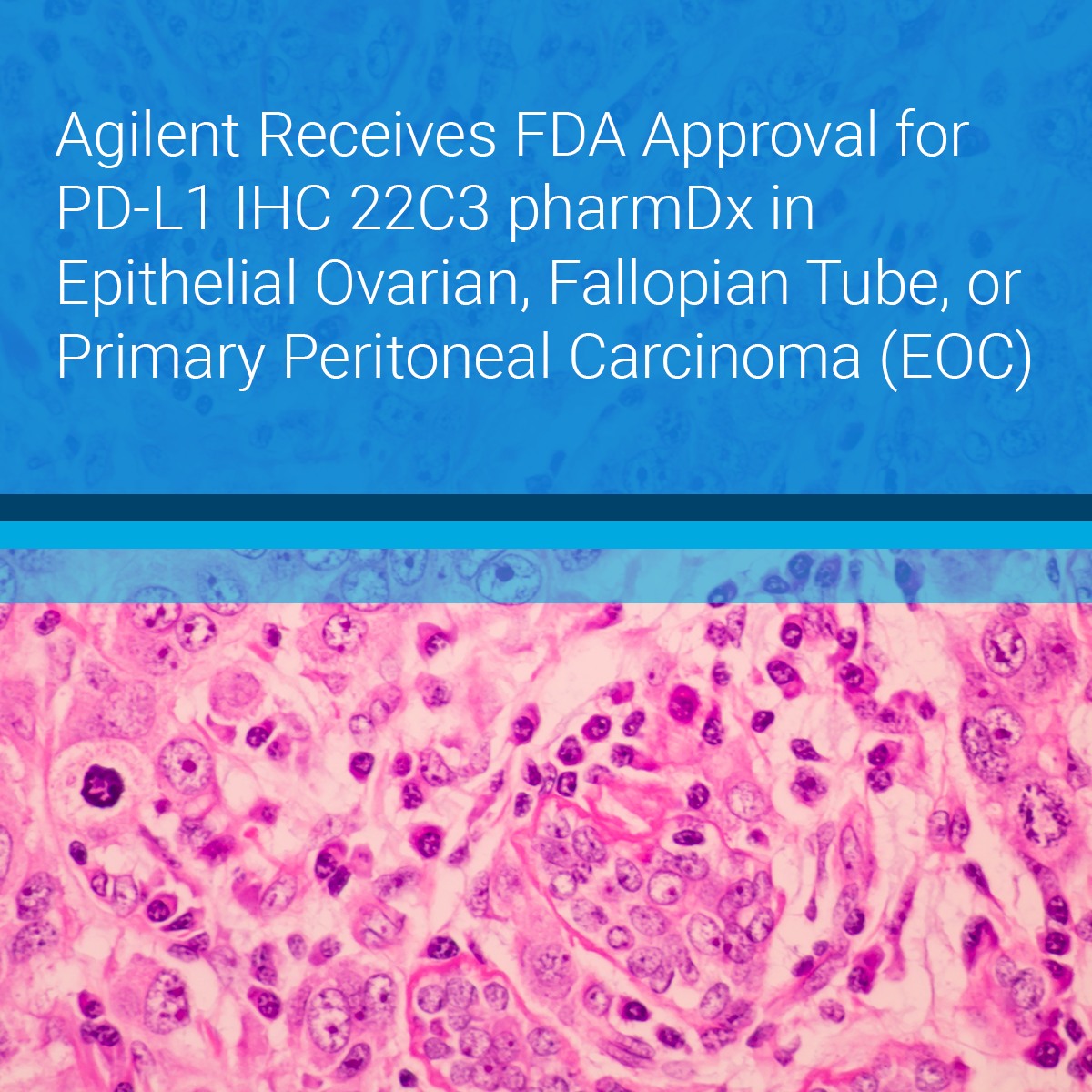 Agilent - Was the Agilent InfinityLab Pro iQ Series the breakthrough in ...