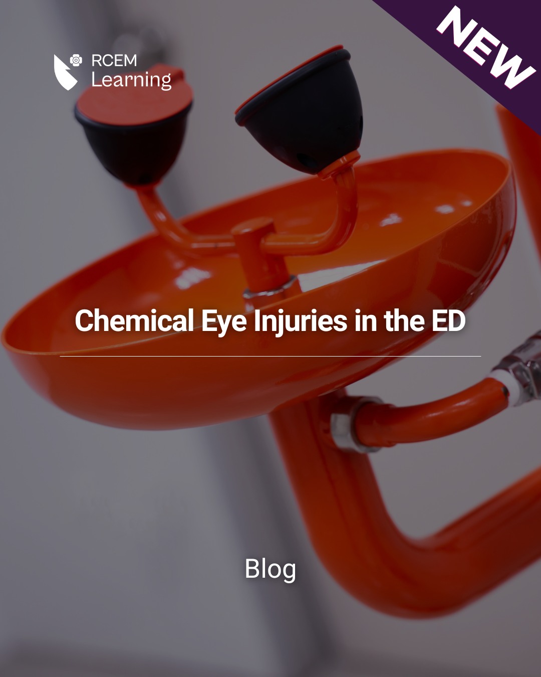 RCEMLearning - NEW: Chemical eye injuries are... | Facebook