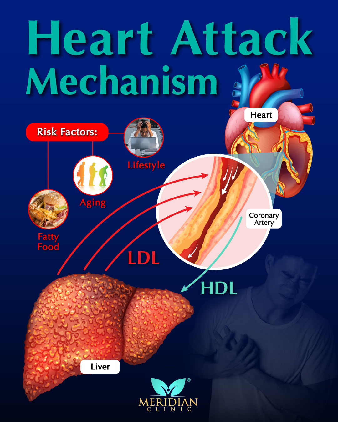 Meridian - Heart disease is one of the leading causes of death among ...