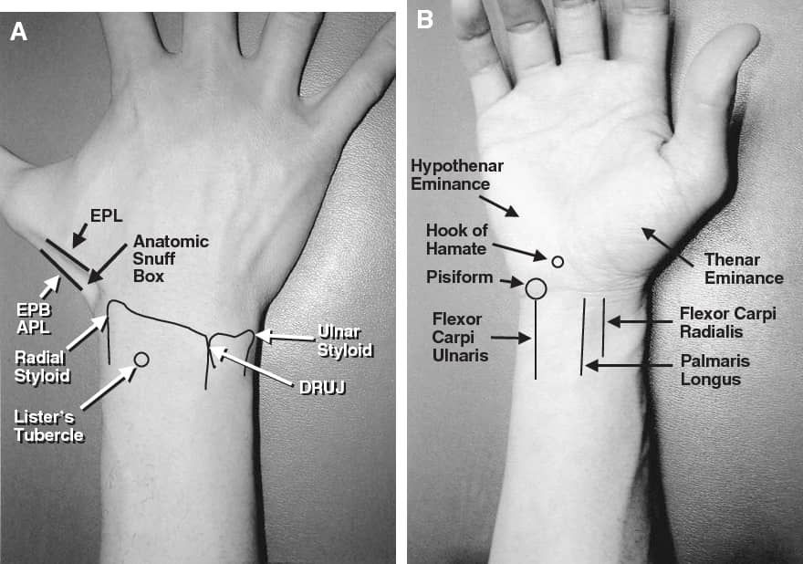 A basic understanding of wrist and... - Professor M. A. Imam | Facebook
