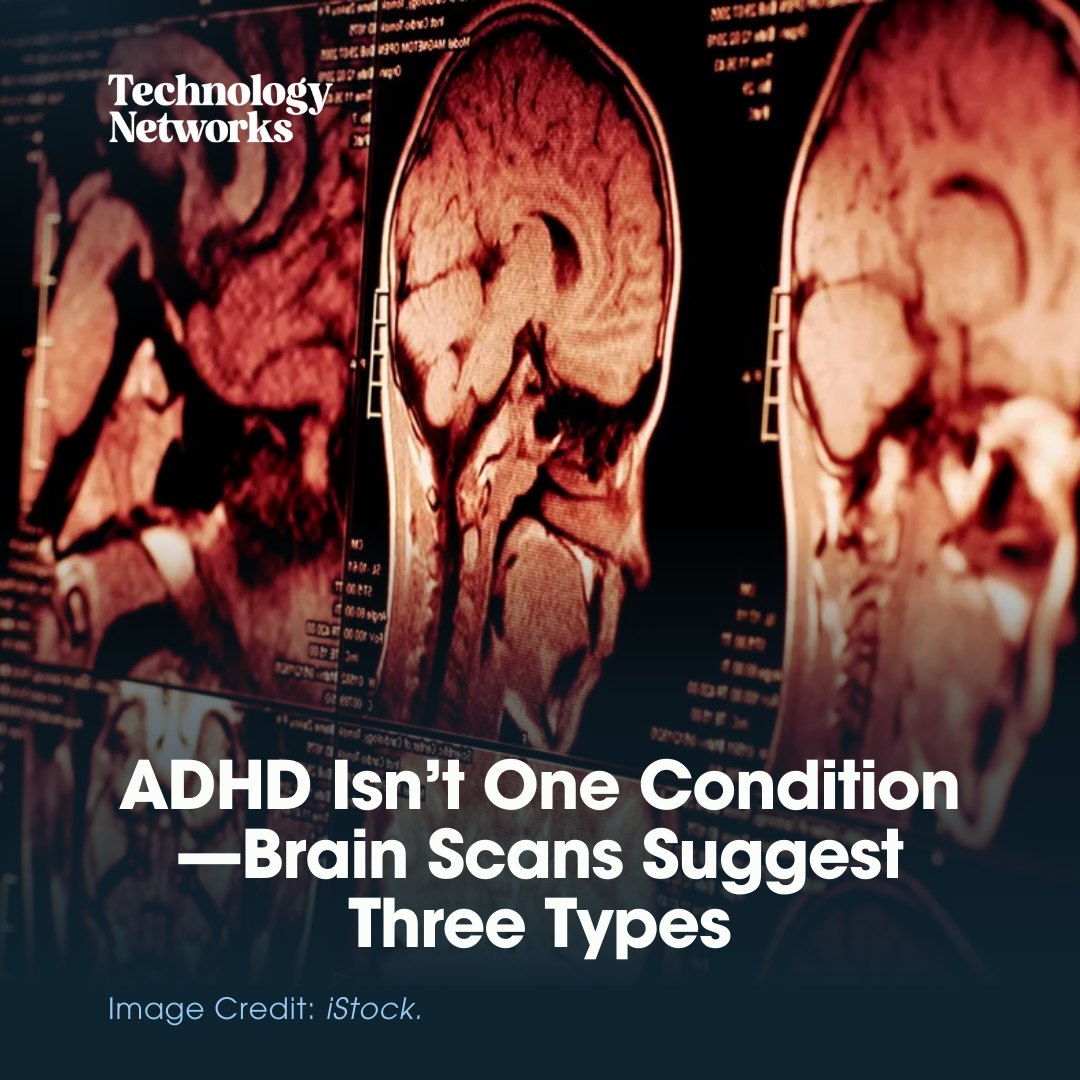 New research has... - Neuroscience News and Research | Facebook