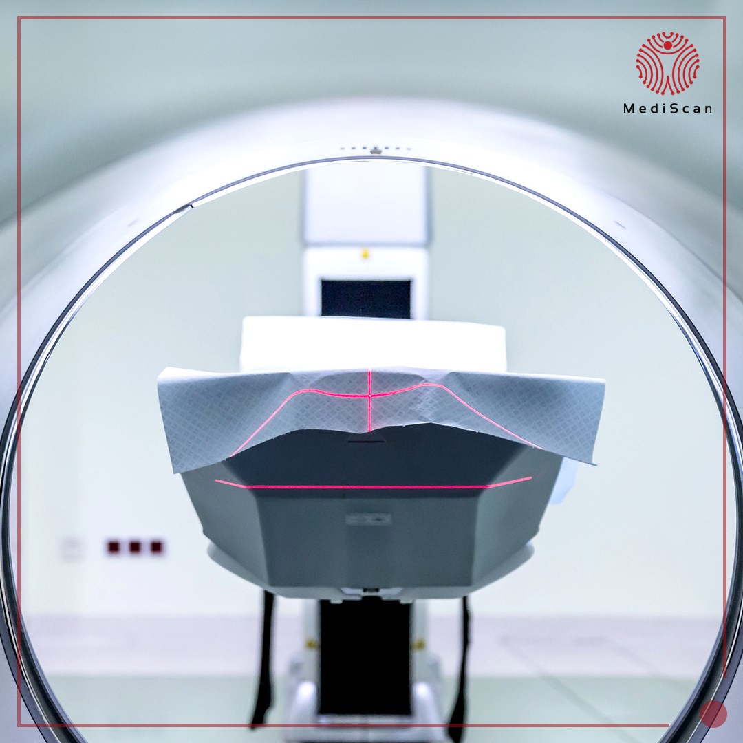 MediScan - The MediScan Technology makes a less expensive...