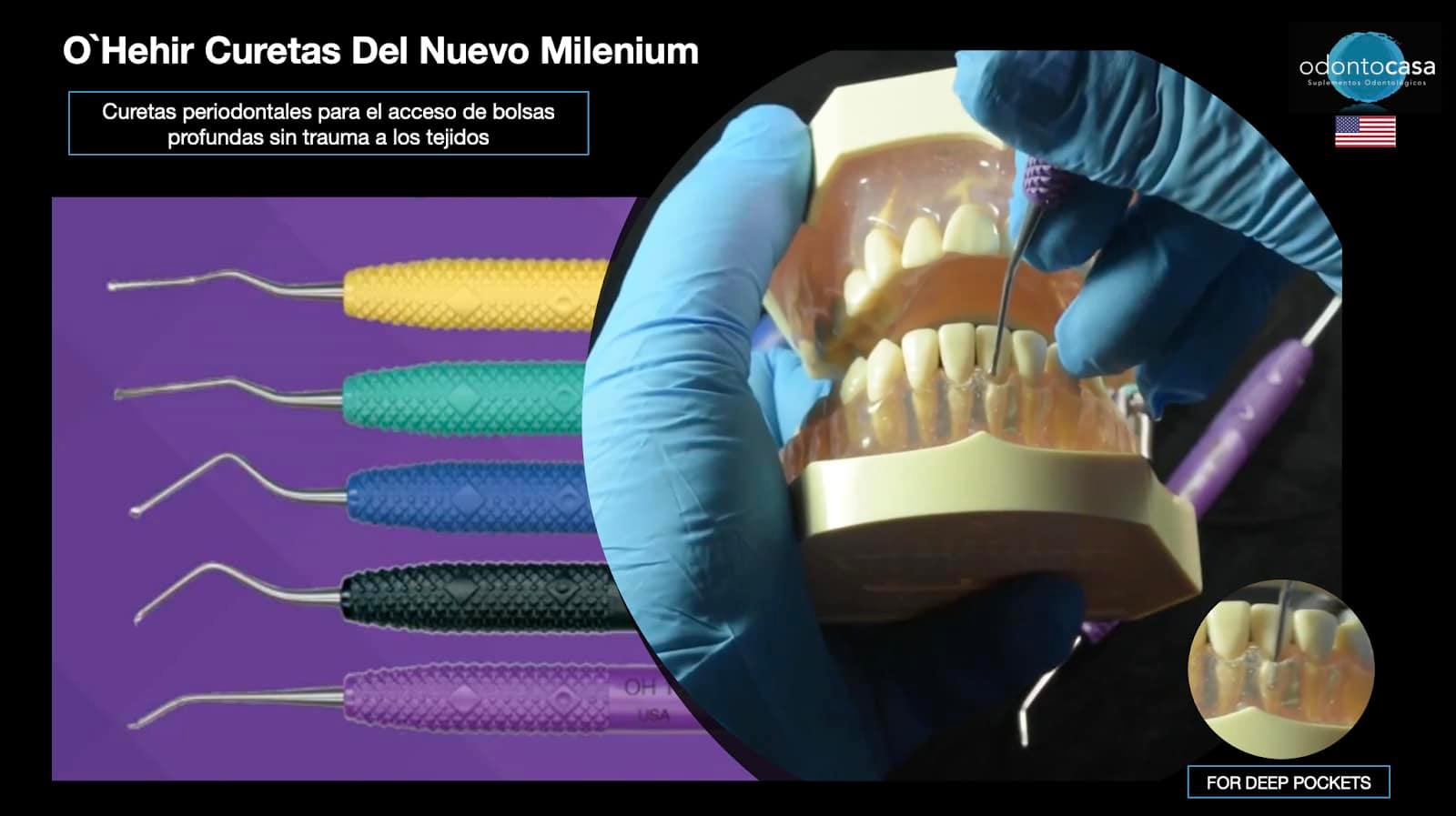 Odontocasa - Las curetas O’Hehir son la nueva innovación para el ...