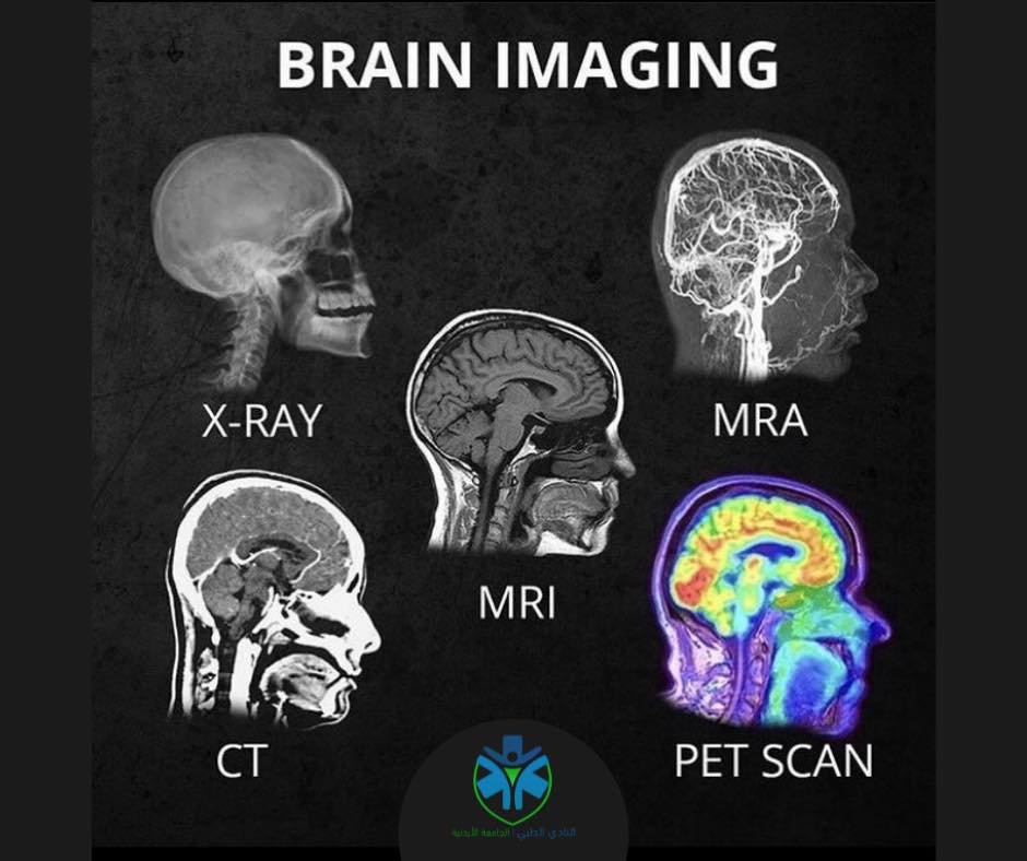 النادي - Types of brain imaging? 🧠 🔴 X-Rays X-rays are a type of ...