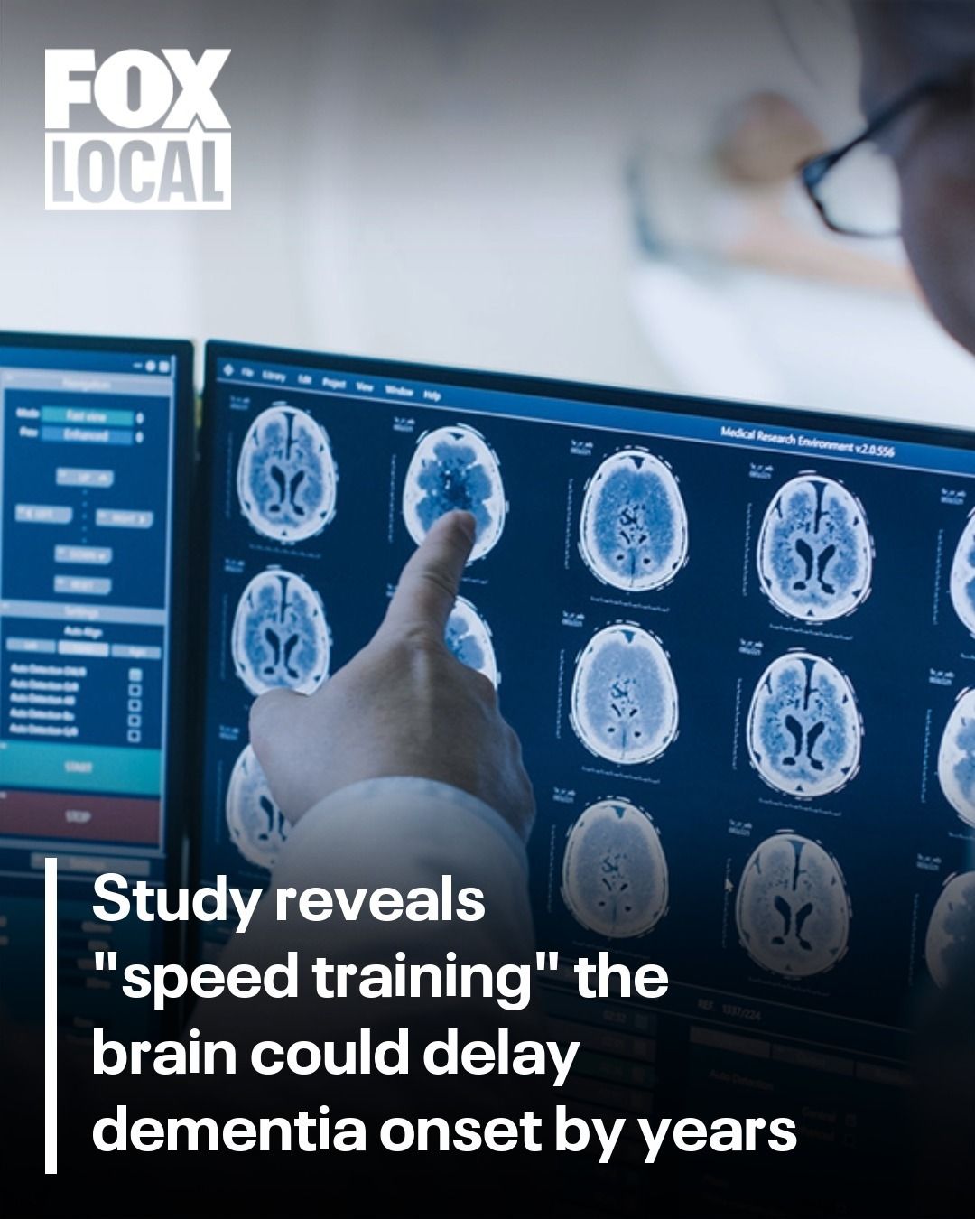 Speed training your brain could help delay developing dementia by