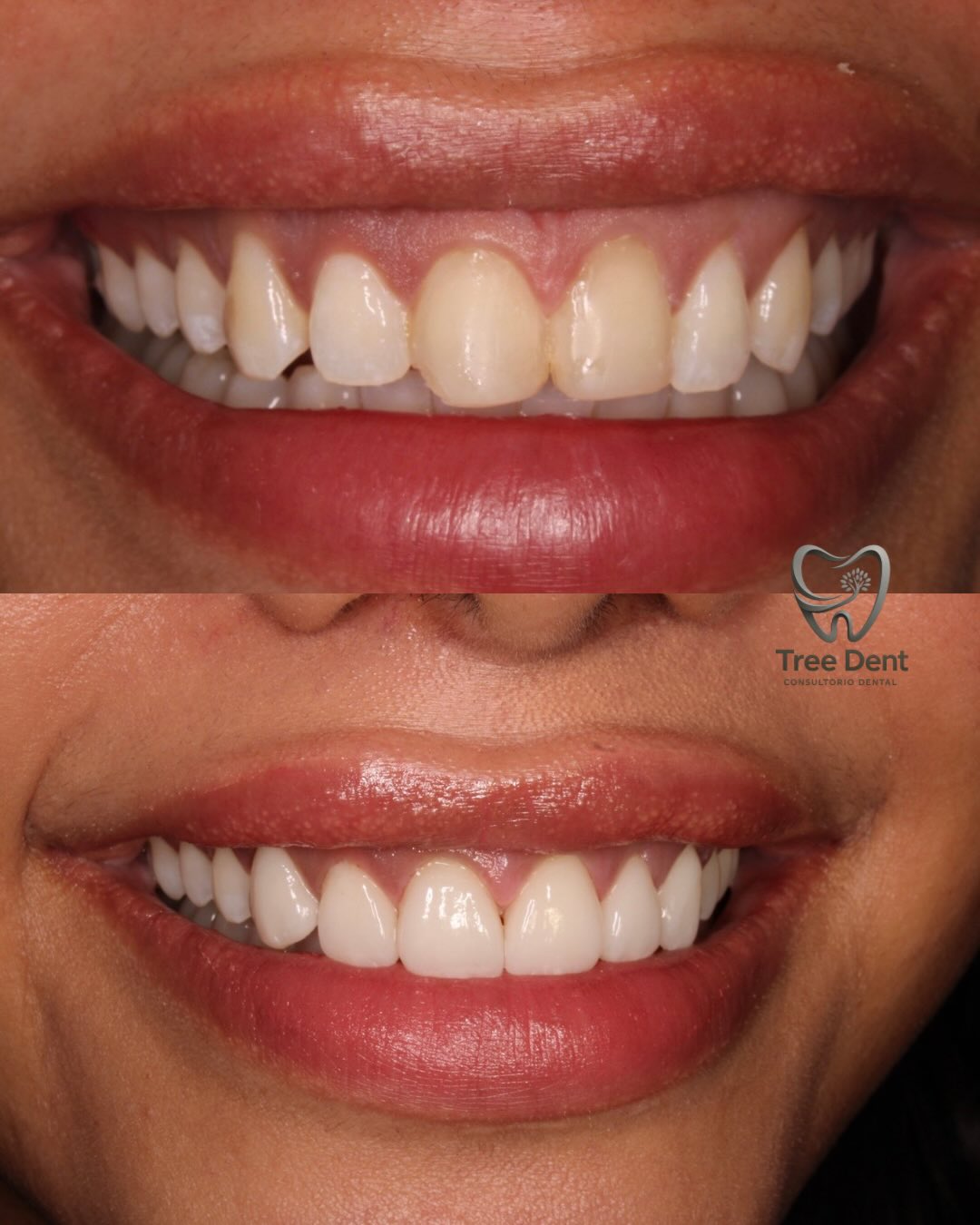 Tree Dent Consultorio Dental | Tuxtla Gutiérrez