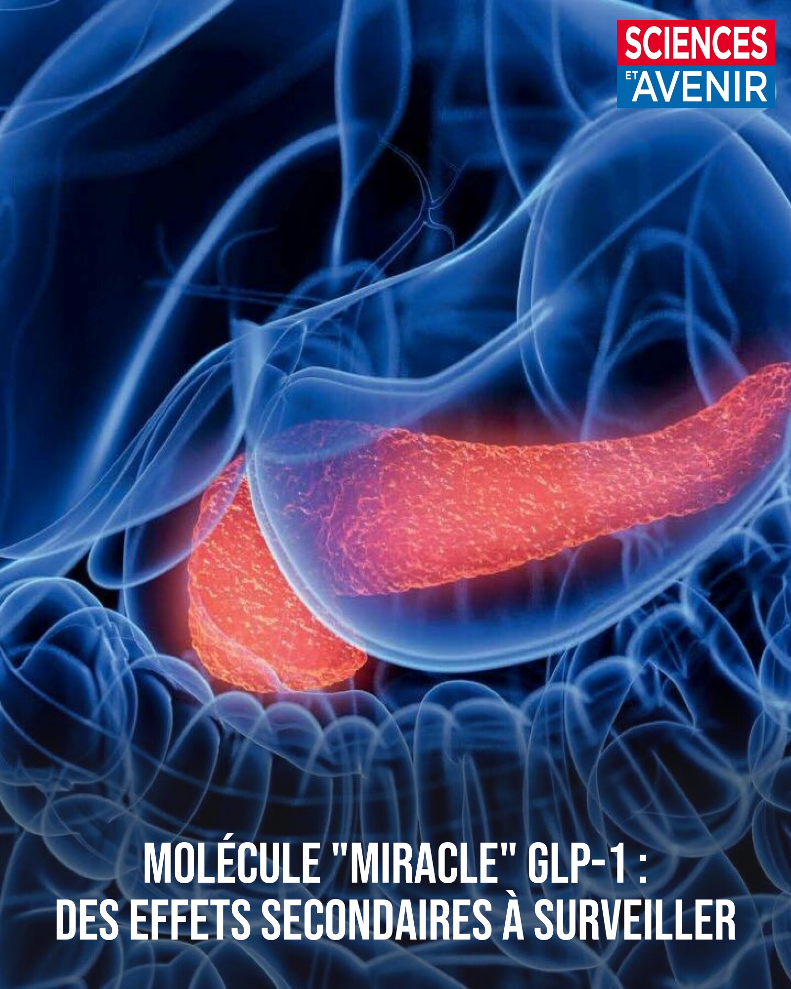 Comme tout médicament, les agonistes des récepteurs du GLP-1 (Wegovy, Ozempic...) ont des effets secondaires. Sciences et Avenir fait le point sur ces effets indésirables. 👉 https://l.sciencesetavenir.fr/pcr