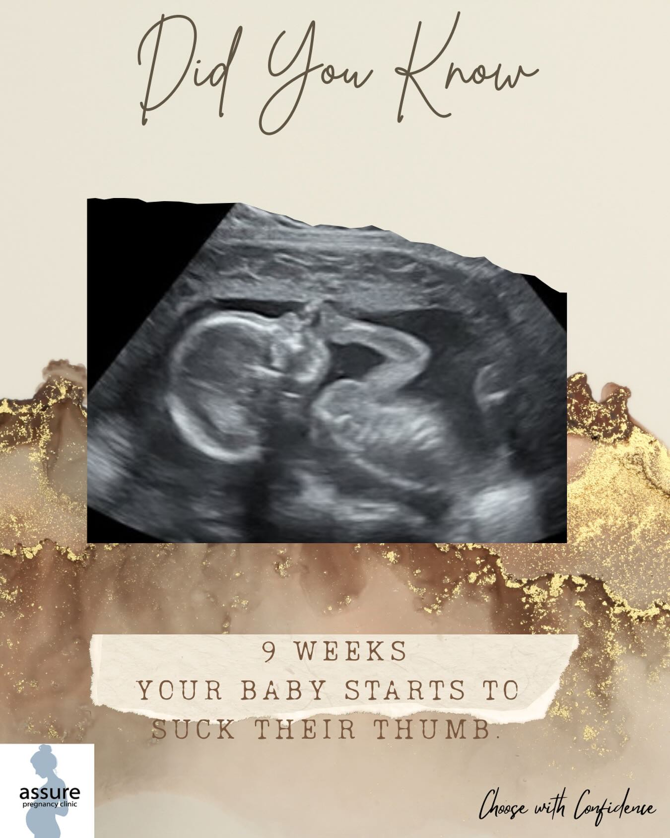Assure - 🍼 Did You Know? 🤰 At just 9 weeks pregnant (that’s only 7 ...