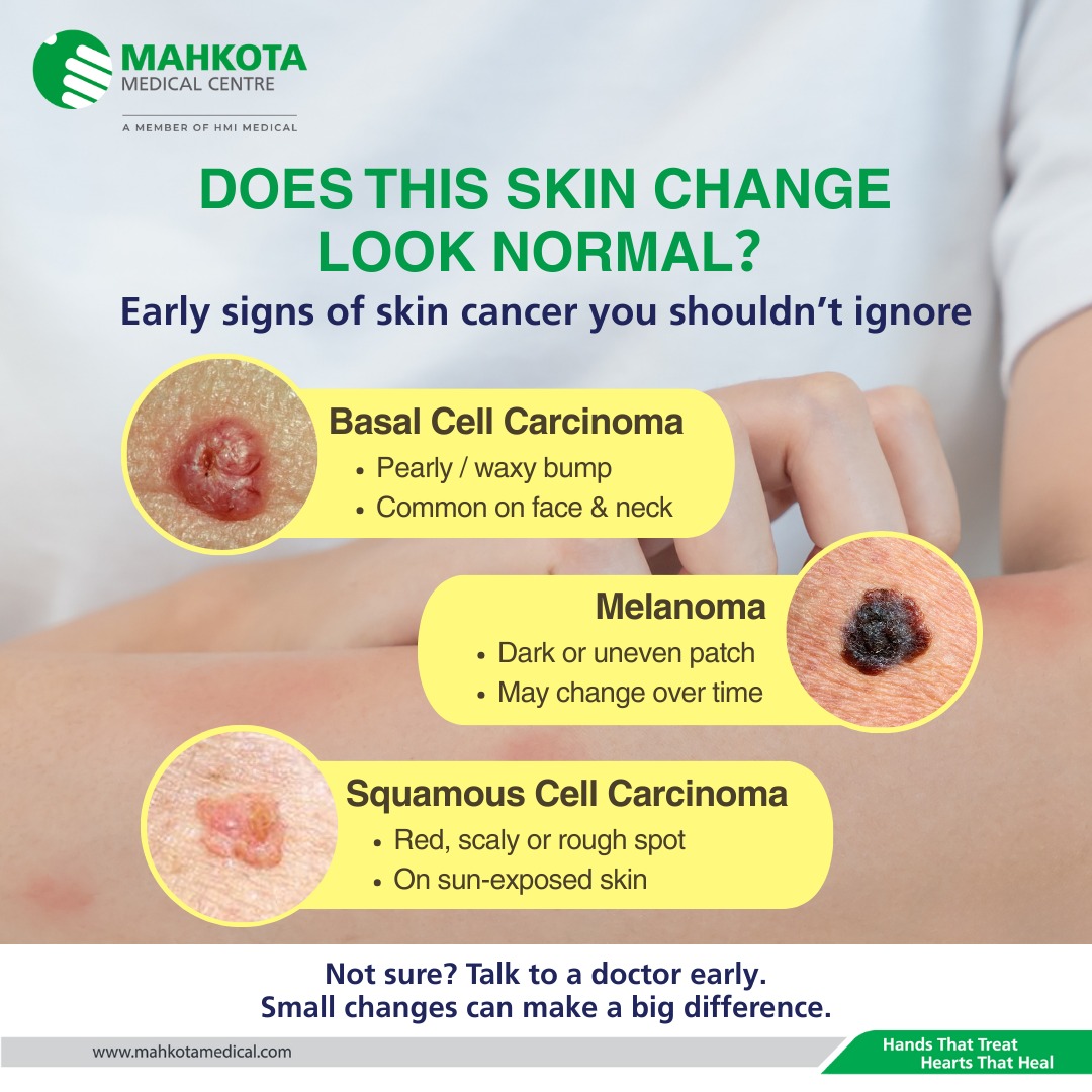 Mahkota Medical Centre added a... - Mahkota Medical Centre