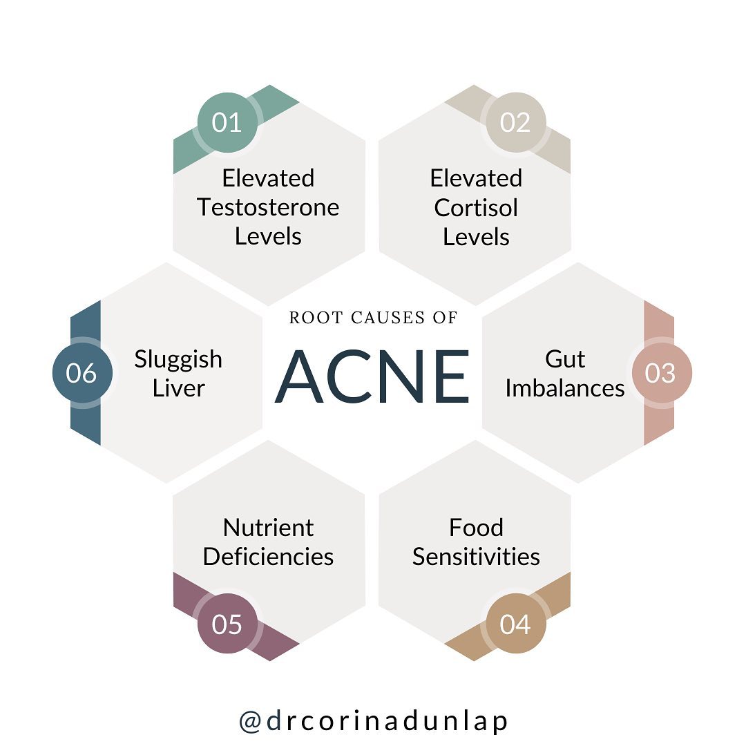 The 6 most common root causes of acne:... - Dr. Corina Dunlap