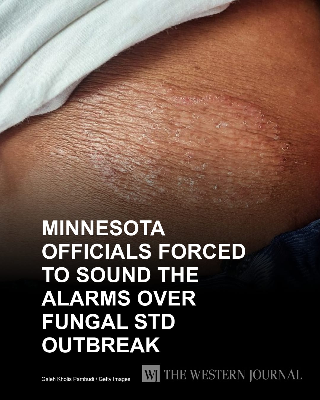 Conservative - Minnesota Officials Forced to Sound the Alarms Over ...
