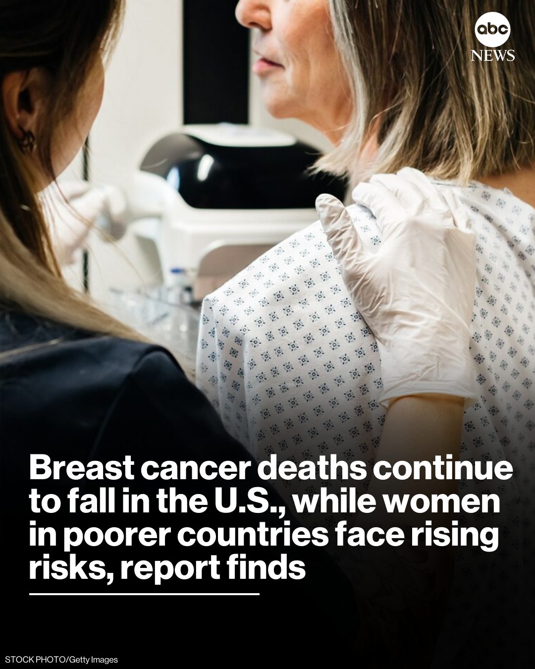 ABC - Breast cancer survival continues to improve in the United States ...