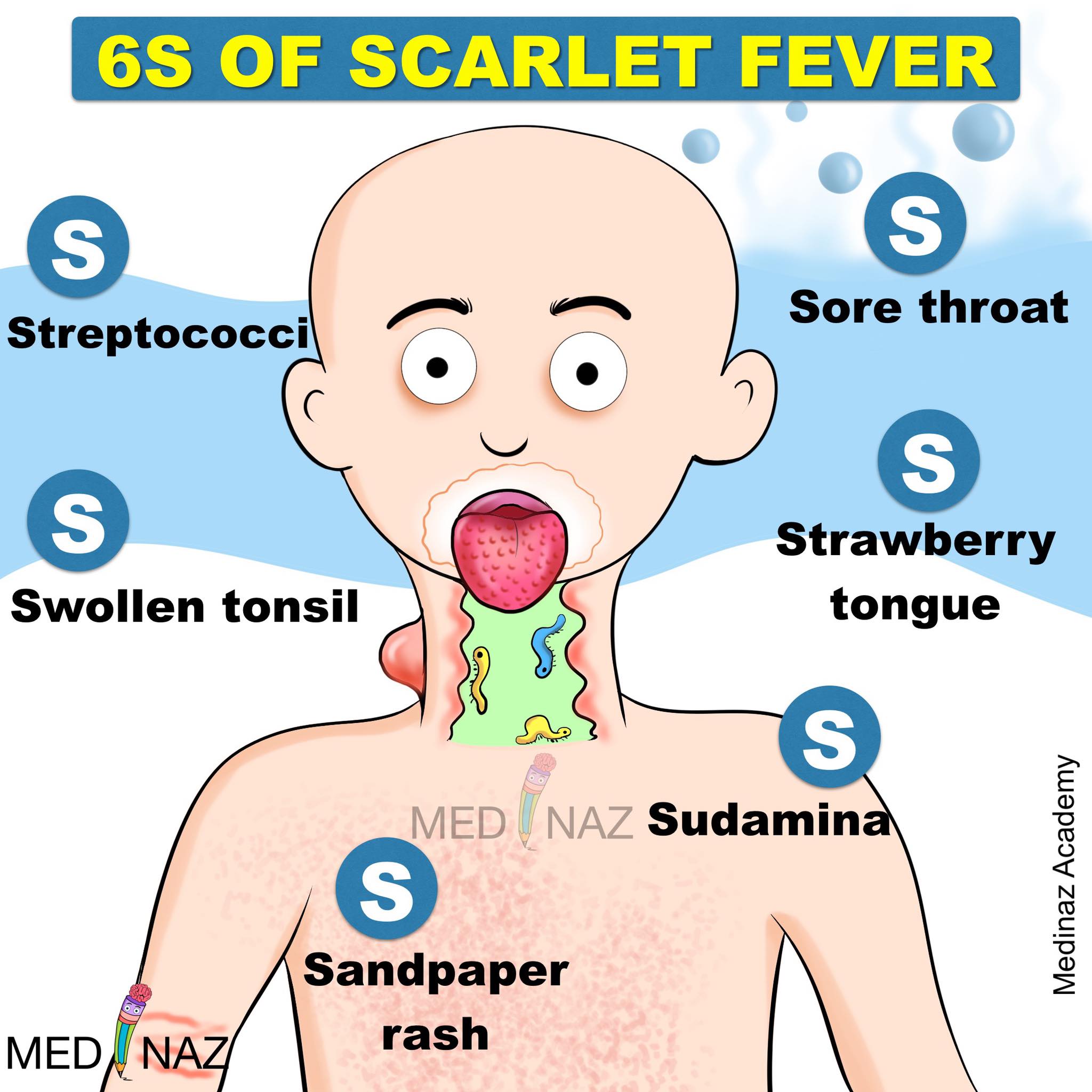 Medinaz - Remember the 6s of Scarlet Fever | Facebook