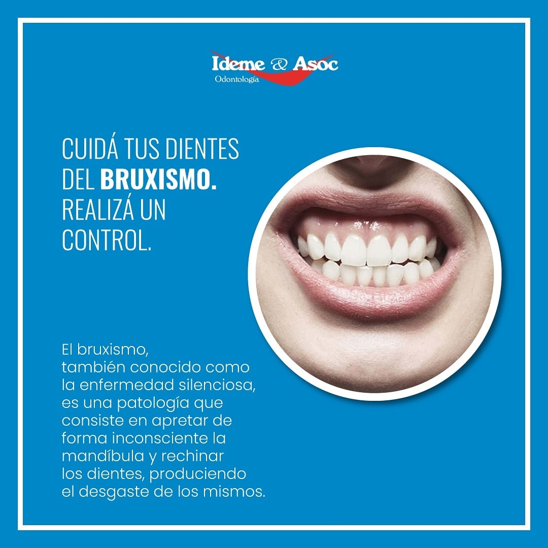 Ideme & Asoc. - 🦷 Este trastorno puede causar que los... | Facebook