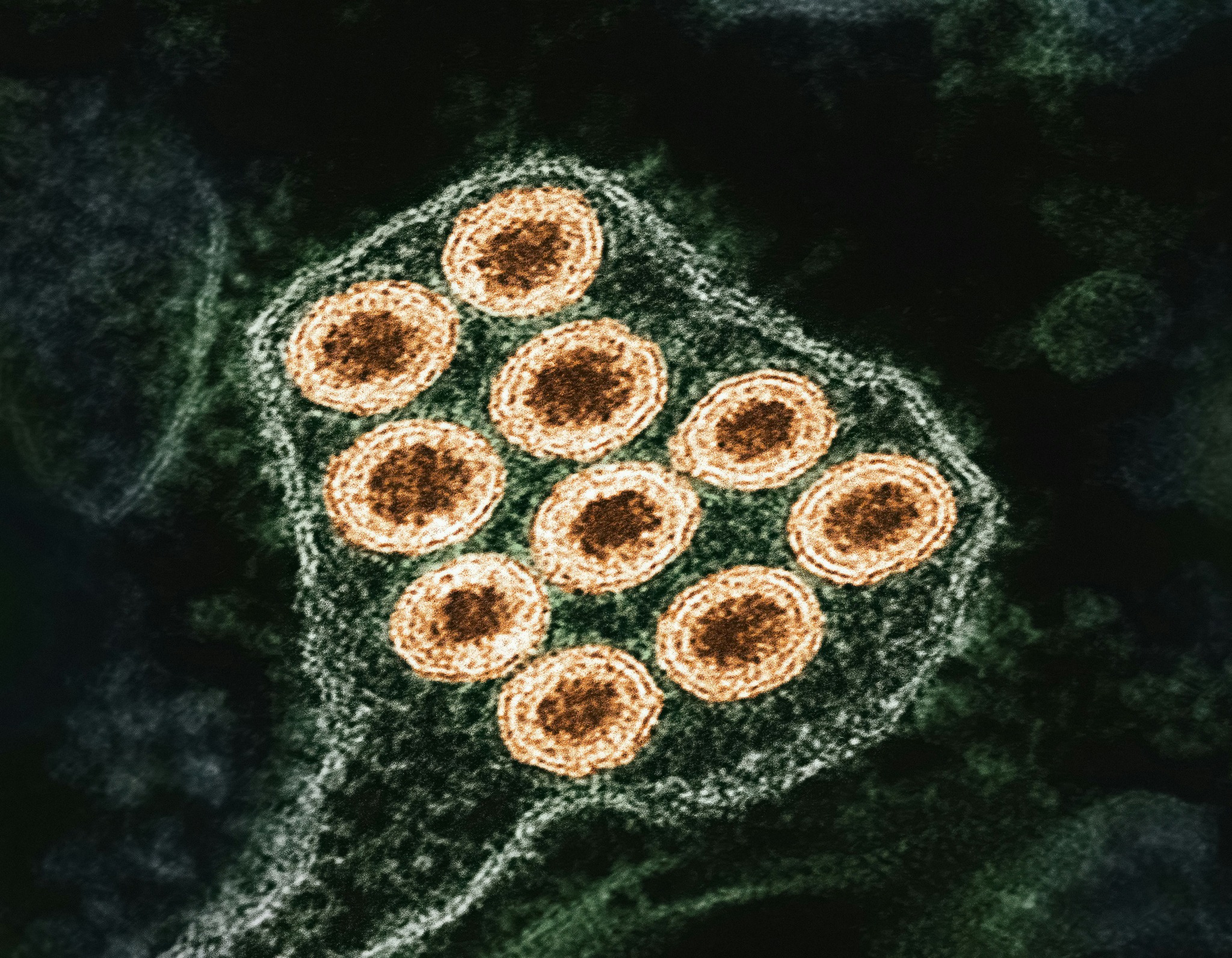 WDIV - Michigan has its first confirmed case of rabies in 2026 -- a bat ...