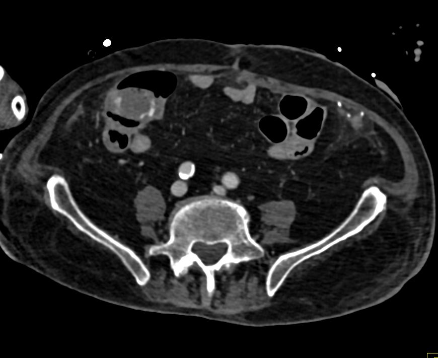 CTisus: Cutting edge information on body CT (Computed tomography ...